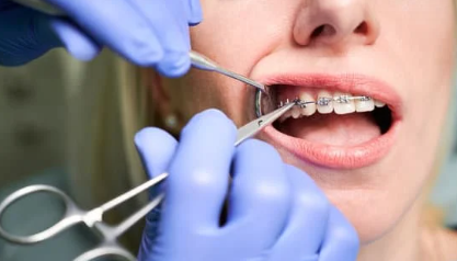 Orthodontist Terdekat Pelayanan Ramah Dengan Dokter Bersertifikat